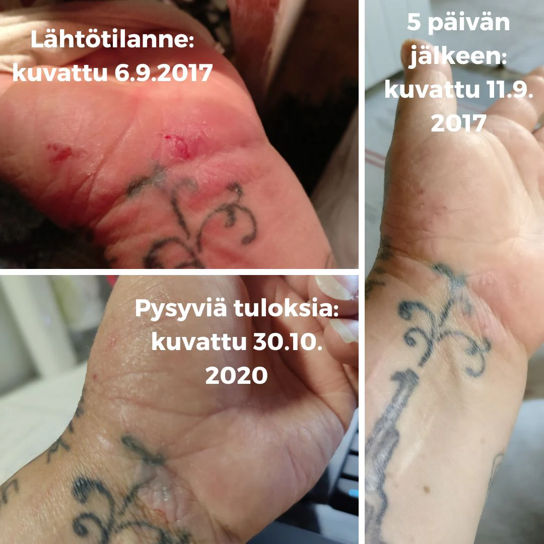 Pikkukuva 3