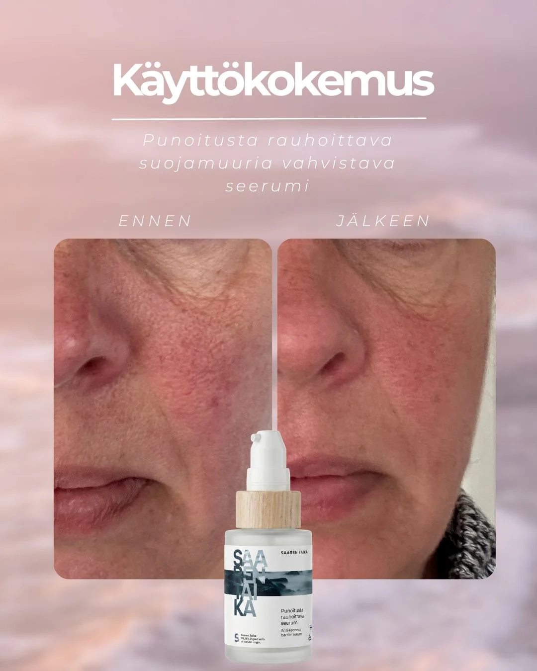 Pikkukuva 5