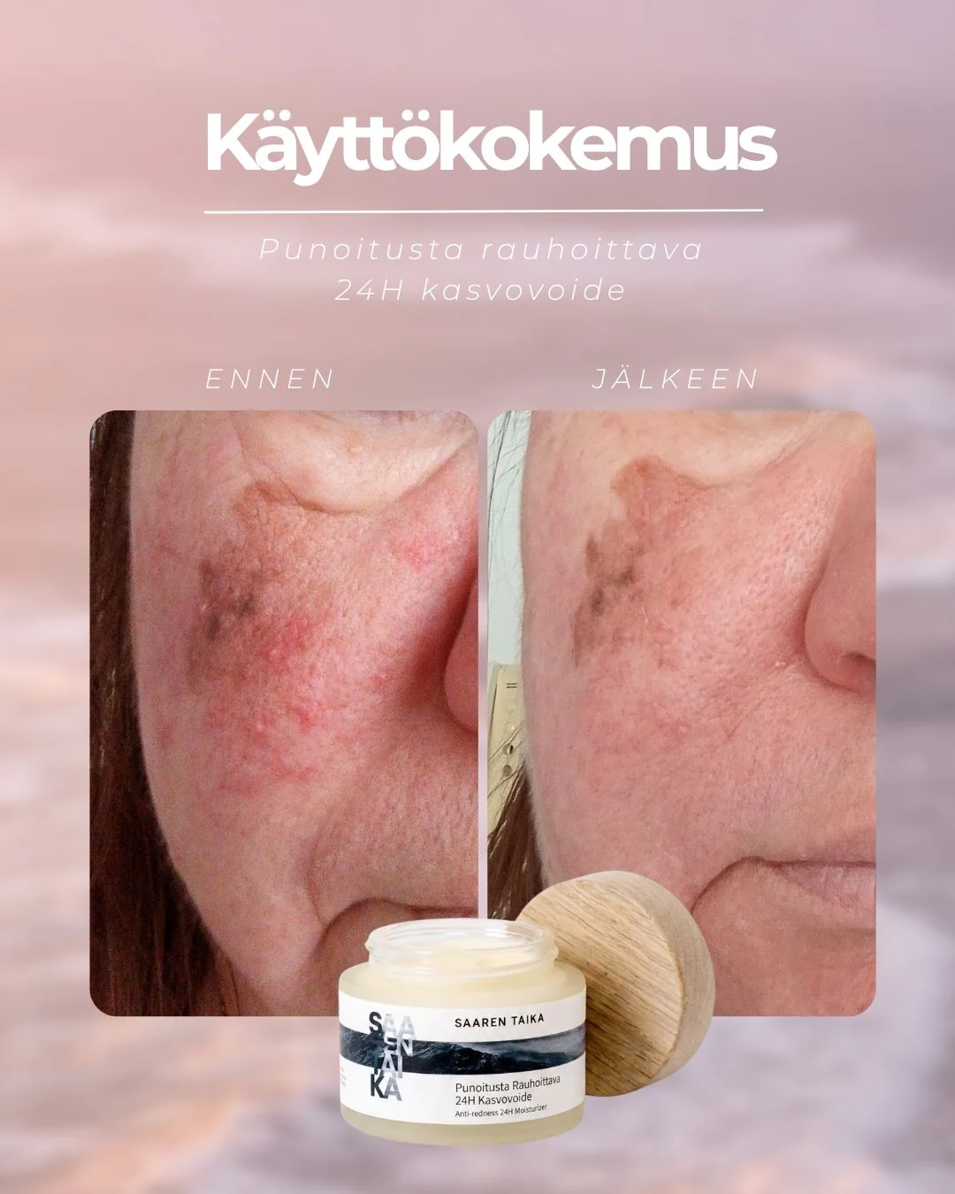 Pikkukuva 6