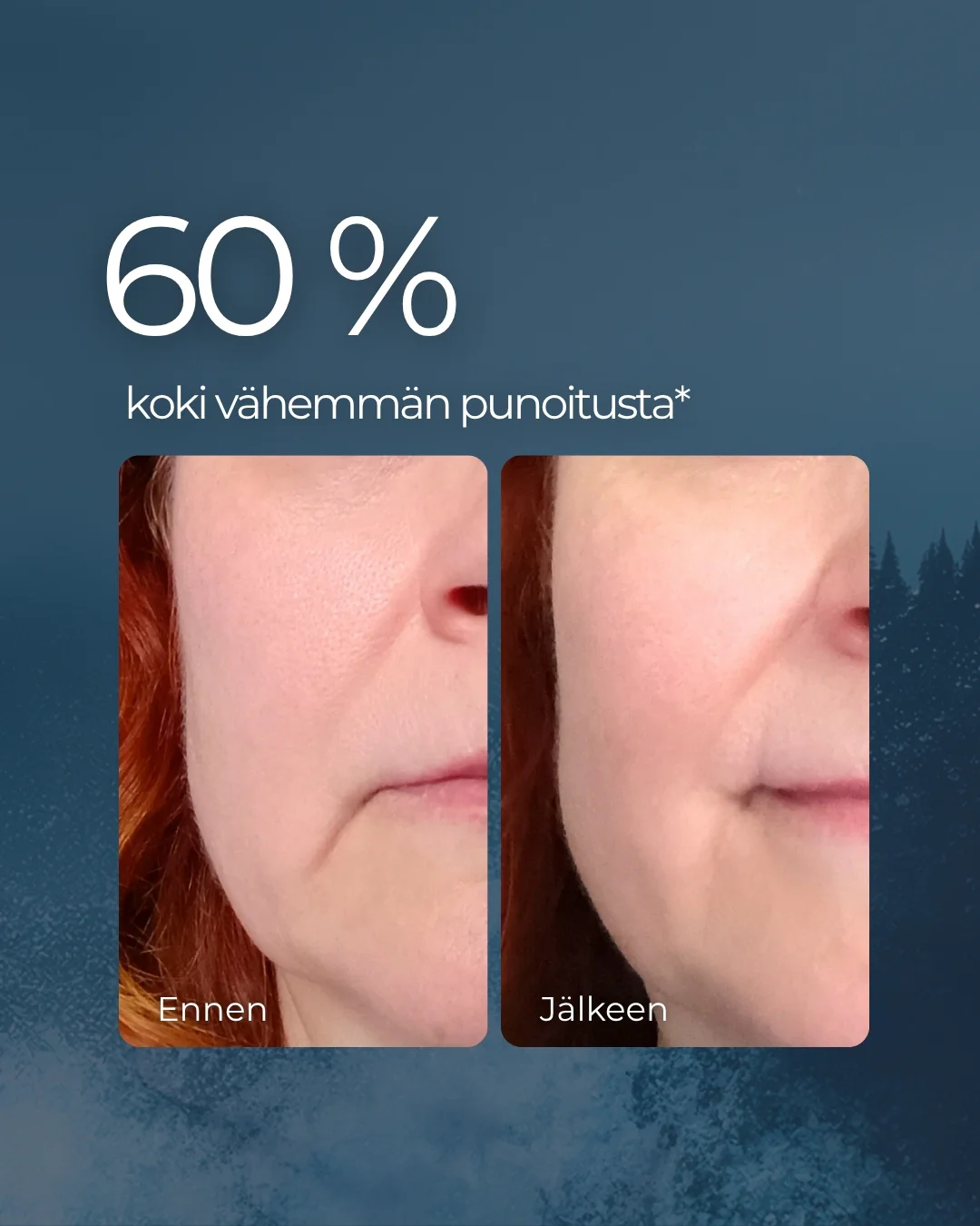 Pikkukuva 4
