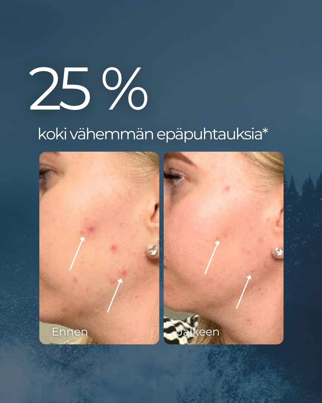 Pikkukuva 5