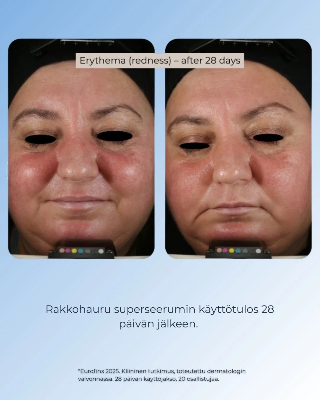 Pikkukuva 4