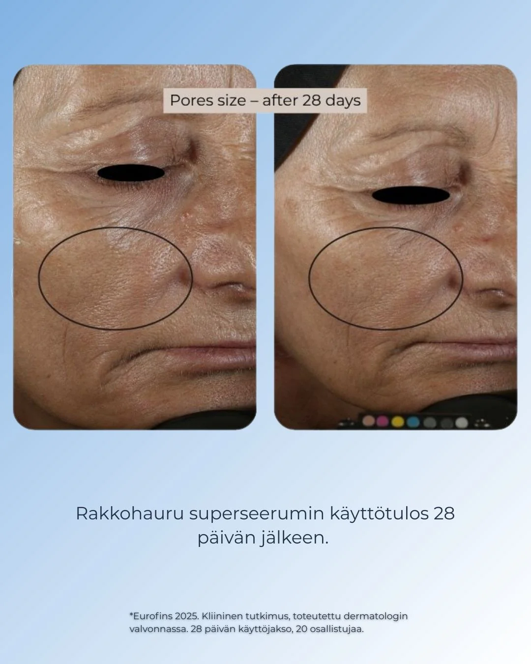 Pikkukuva 6