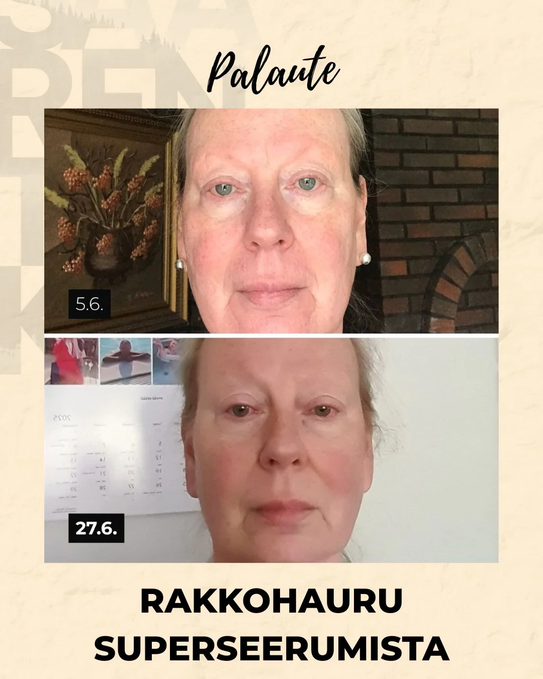 Pikkukuva 20