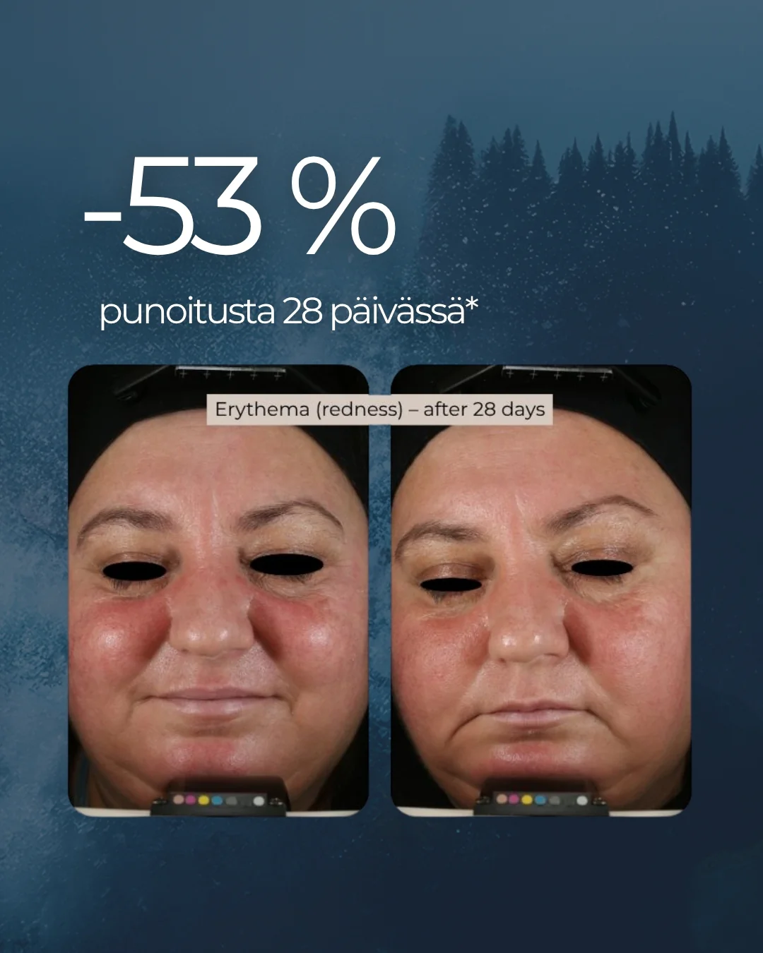 Pikkukuva 5